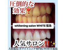 ホワイトニングサロン ホワイト(WHITE)/セルフホワイトニング/大阪/福島