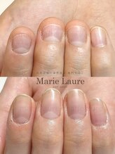 マリーロール 淀屋橋本店(Marie Laure)/自爪育成/深爪矯正/ネイルケア