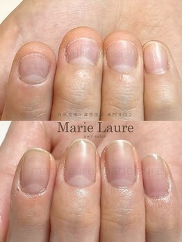 マリーロール 淀屋橋本店(Marie Laure)/自爪育成/深爪矯正/ネイルケア