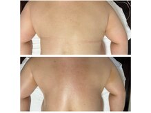 美温(mion)/自律神経を整えていたら…