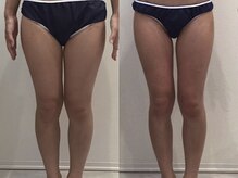 ビラ 銀座店(BILA)/キャビラジ