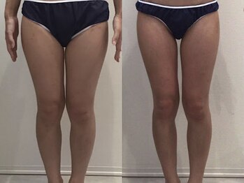 ビラ 銀座店(BILA)/キャビラジ