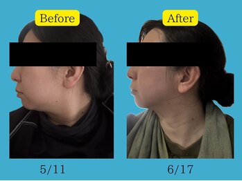 ヨサパーク ハーブCOCO和 北名古屋店(YOSA PARK)/◇フェイスライン◇