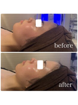 ブリス(BLiSS)/水素クレンジング