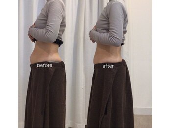 ジョワイユ(Joyeux)/腸の位置でお腹は変わる