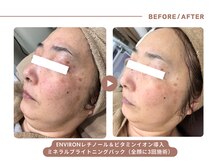 イエス マイサロン(yes My Salon)/ENVIRONトリートメント症例