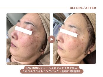イエス マイサロン(yes My Salon)/ENVIRONトリートメント症例
