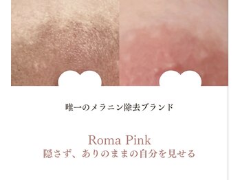 アンリミット(Unlimit)/産後のニップルをピンクに！