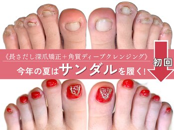 アモ 坂戸(’Amo)の写真/「爪が恥ずかしいからサンダルを履けなかった」そのお悩み2026年は解決しませんか？フット深爪矯正/坂戸