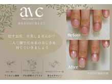 アーク(arc)
