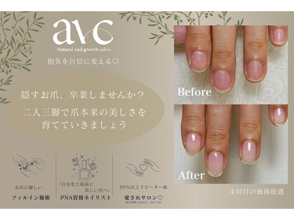 アーク(arc)の写真