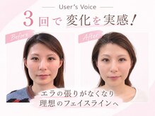 小顔美肌ファクトリー 金沢院