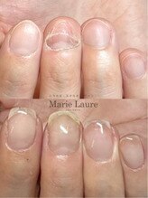 マリーロール 梅田店(Marie Laure)/自爪育成/深爪矯正/ネイルケア