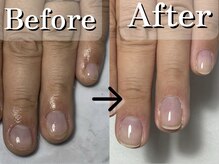 エヌプロテクト(N.Protect)/