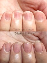 マリーロール 梅田店(Marie Laure)/深爪矯正/自爪育成/自爪風