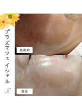 ソーハート(So Heart)/☆大人気！エイジングケアに特化