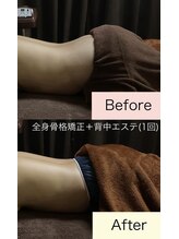 ディライト(D-LIGHT)/全身骨格矯正＋背中エステ