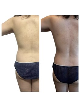 美温(mion)/40代本気痩身 2