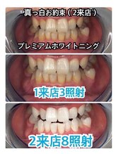 プラチナムビューティー 川口駅前店(PLATINUM BEAUTY)/ジェルありビフォーアフター