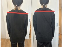 リフー(Re:fuu)/ビフォーアフター