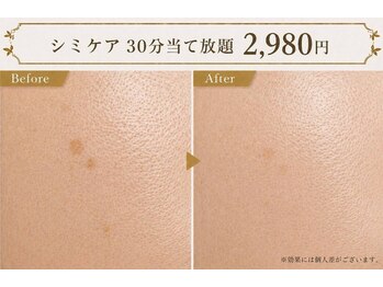 トムズ(Tom’s)/Othelloシミケア
