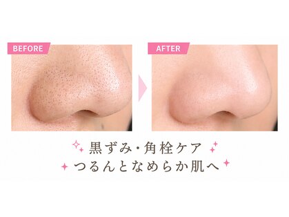 ノエルの写真