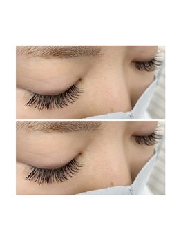 オーク アイラッシュアンドネイル たまプラーザ(OAK)/バインドロック100束