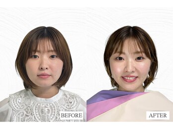 リベルテ(Liberte)