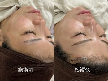 リリー(Lily)/フェイシャルwax＆クレイパック