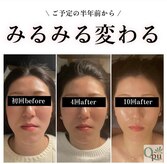 キュープ 鹿児島西陵店(Qpu)