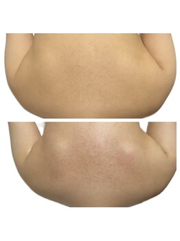 美温(mion)/花嫁様の掘り出し肩甲骨