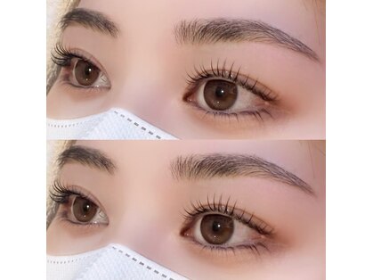 リリー(LILY)の写真