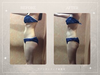 アバンダンティア 姫路店/キャビテーション