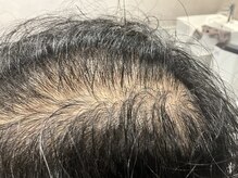 トウキ(TOUKI)/育毛促進メニュー強髪プログラム