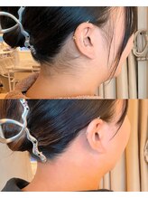 リリー(Lily)/【WAX脱毛】