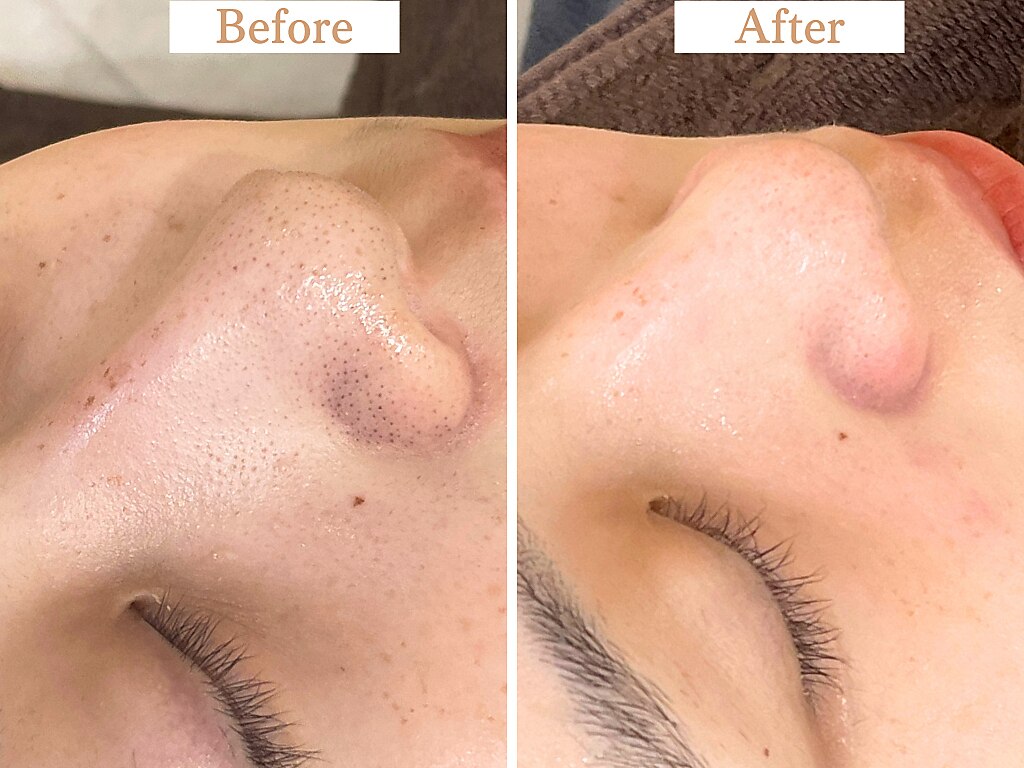 フローフシ∞｜ホットペッパービューティー