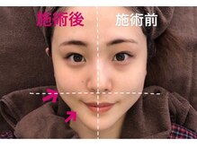クレモール(CREMOR)の雰囲気（頭皮も小さく小顔とのバランスを見極め解します/ヘッドスパ）