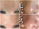 ホワイトアクア 鳳店(WHITE AQUA)の写真