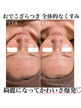ラクシュミー ナチュラル(Laksmy NATURAL)/お客様ビフォーアフター