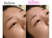 イーサム(e-sam)/美眉WAX脱毛