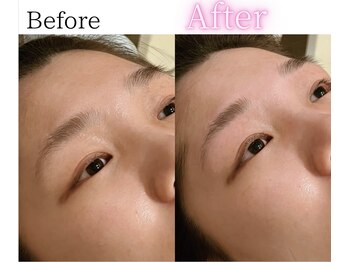 イーサム(e-sam)/美眉WAX脱毛