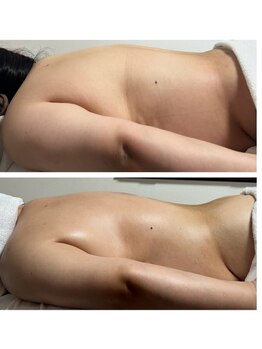 美温(mion)/痩身目的じゃ無いのに…