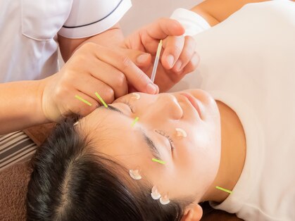 ムネトモ鍼灸院の写真