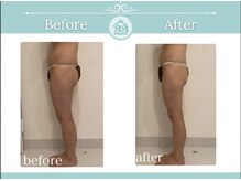 美人バスト 掛川店/痩身症例