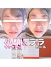 ＜最強タッグ☆＞小顔ハンド＋ララピール(ヘッド付) 100分 22,000→13,500円