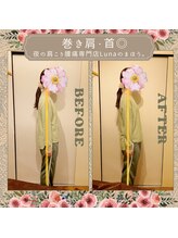 イレミア 北千住(IREMIA)/首がハリやすい方へ