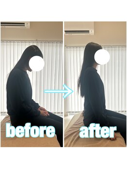 アオ 香椎(AO)/施術前→施術後