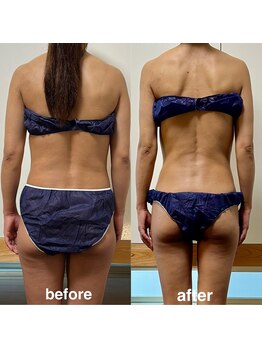 ソラ(sola*)/痩身全身