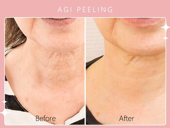 シロカネ イオンタウン西熊本店(SHIROKANE)/アギピーリング☆