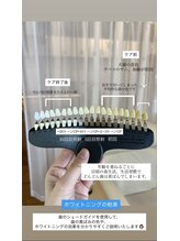 ホワイトニングショップ 桜木町店/あ